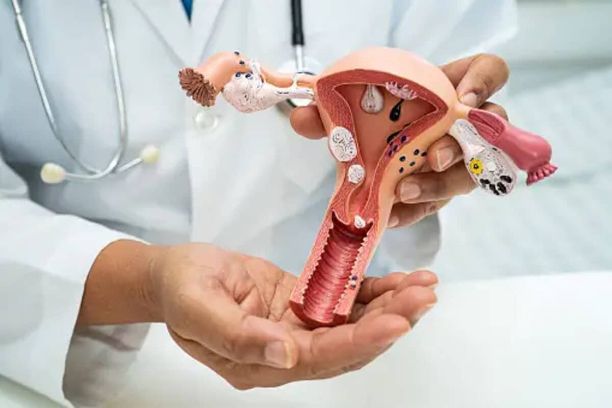 Cuáles son las medidas para prevenir el cáncer de cuello uterino 