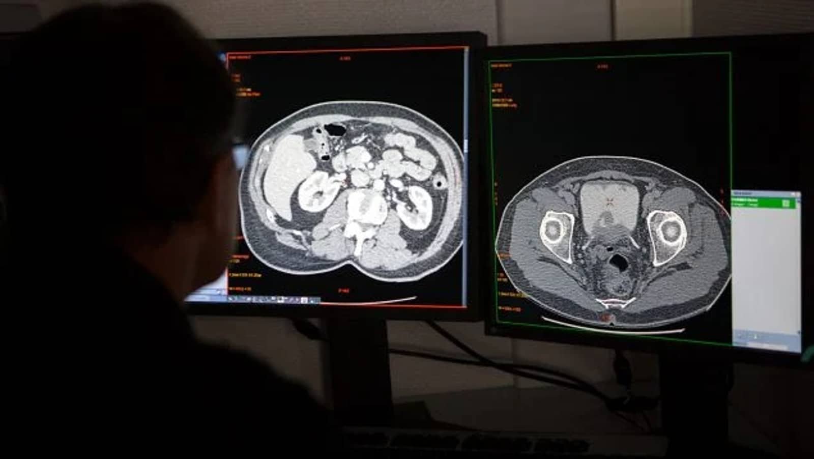 Implante inteligente podría mitigar los problemas de movilidad en pacientes con Parkinson
